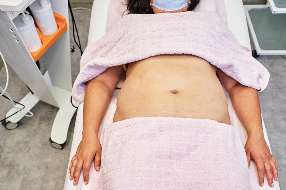 Liposucción en Colombia