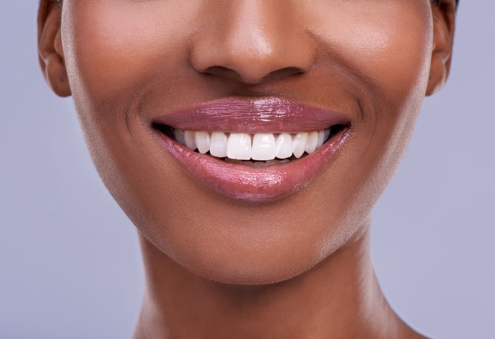 diseño de sonrisa en Panamá