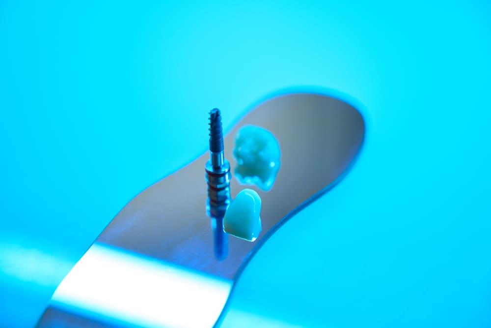 implante dental en Panamá