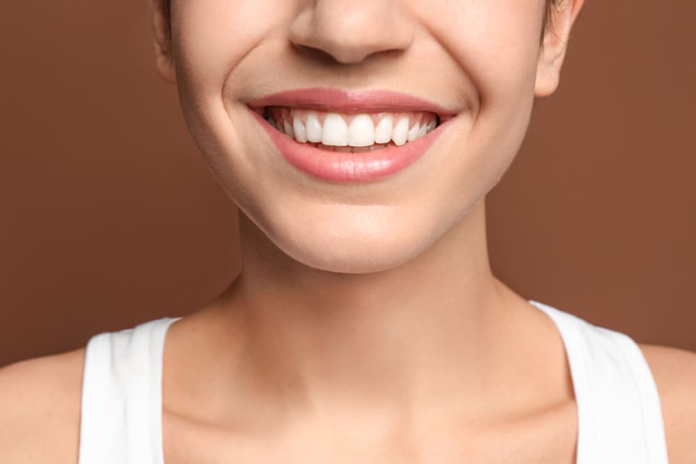 diseño de sonrisa en Panamá
