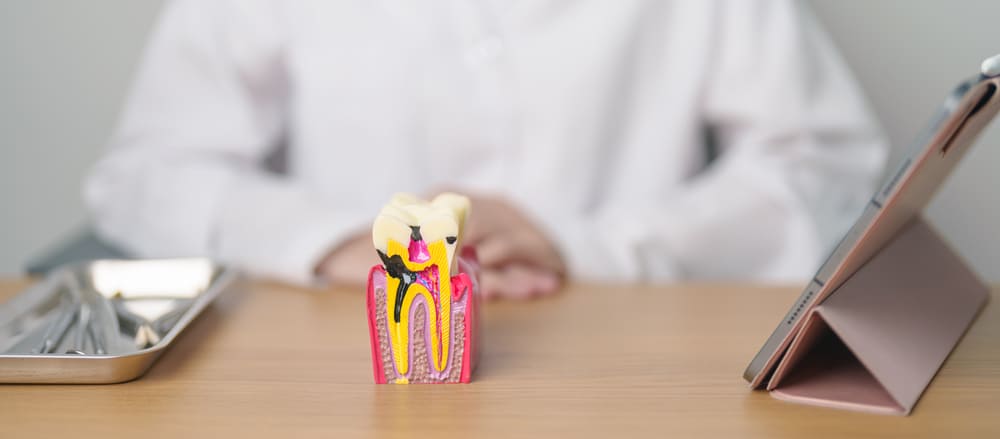 especialistas en endodoncia en Panamá