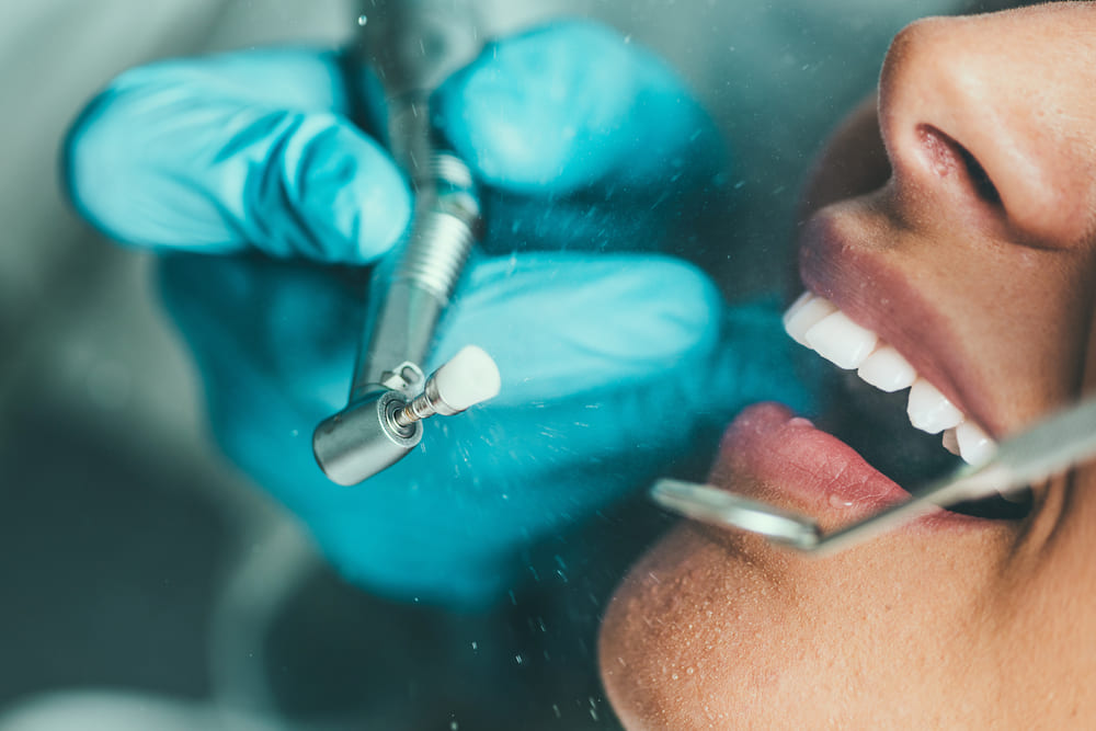 limpieza dental