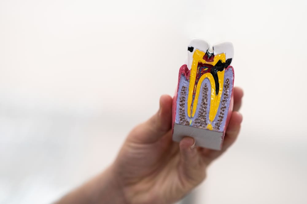 especialistas en endodoncia en Panamá