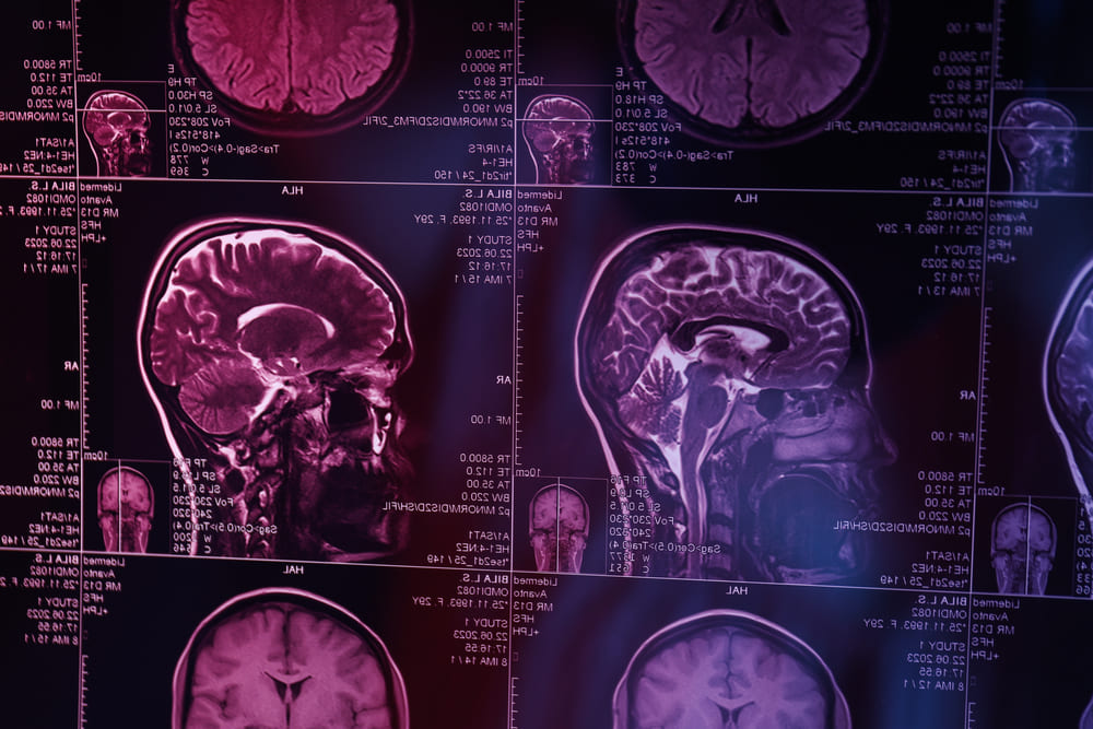 Hospital El Pilar fomenta la colaboración entre especialistas en neurocirugía en Guatemala