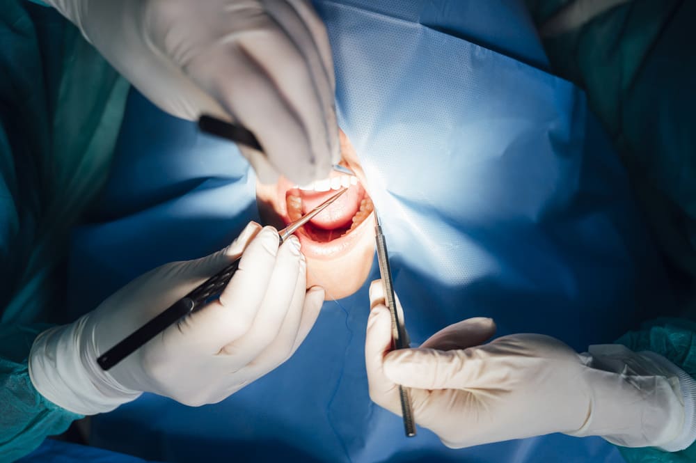 Beneficios de la rehabilitación oral completa para la salud y función dental en Panamá