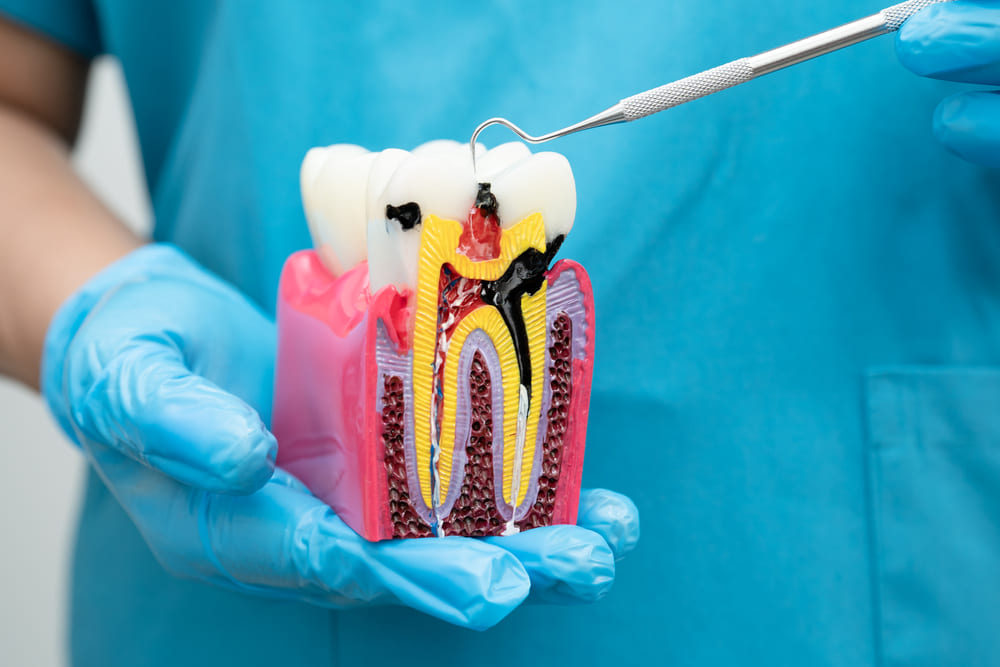 Enfermedades que trata la periodoncia en Panamá y cómo prevenirlas